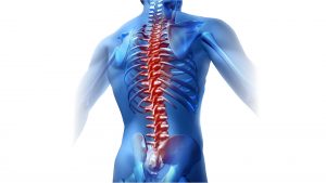  Spinal Cord Stimulation