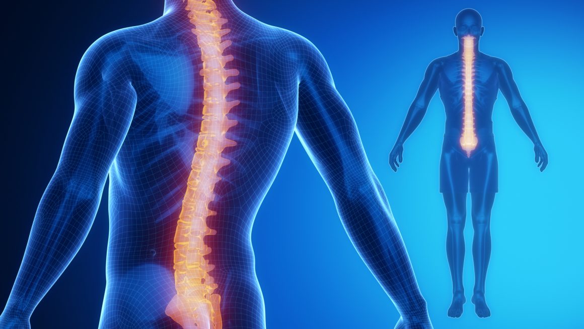 Scoliosis And Deformity Treatment